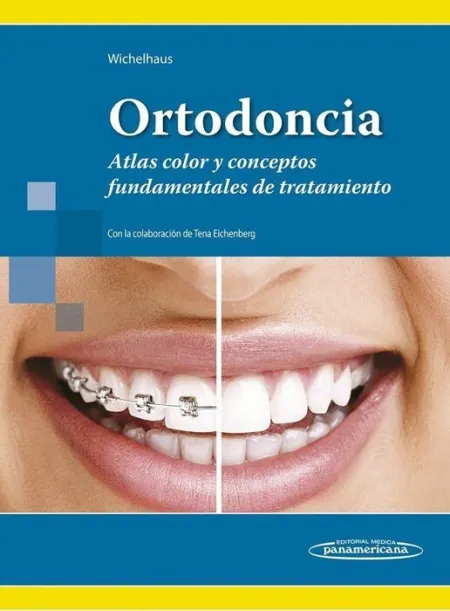 Ortodoncia. Atlas Color y Conceptos Fundamentales de Tratamiento