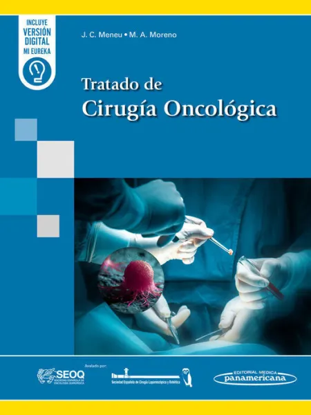 Tratado de Cirugia Oncologica
