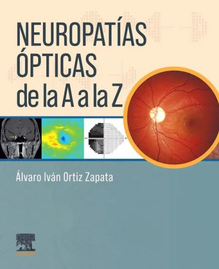 Neuropatias Opticas de la a a la Z