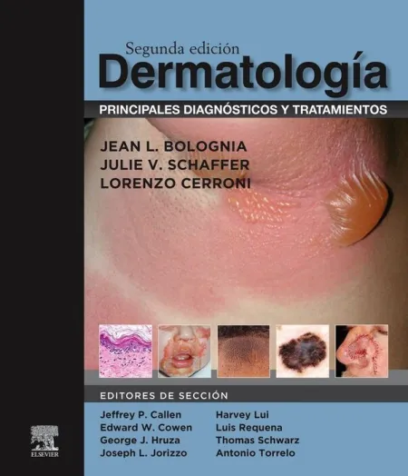Dermatología: Principales Diagnósticos y Tratamientos, 2. ª Edición