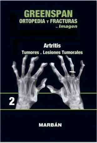T2 Greenspan Ortopedia y Fracturas en Imagenes: Artritis. Tumores y Lesiones Tumorales