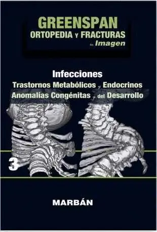 T3 Greenspan Ortopedia y Fracturas en Imagene: Infecciones. Trastornos Metabolicos y Endocrinos. Anomalias Congenitas y del Desarrollo