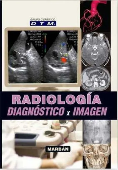 Radiologã­a Diagnã³Stico X Imagen