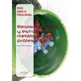 Restauracion y Estructuras Metalicas en Protesis Fijas