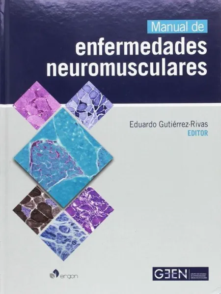 Manual de Enfermedades Neuromusculares