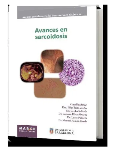 Avances en Sarcoidosis