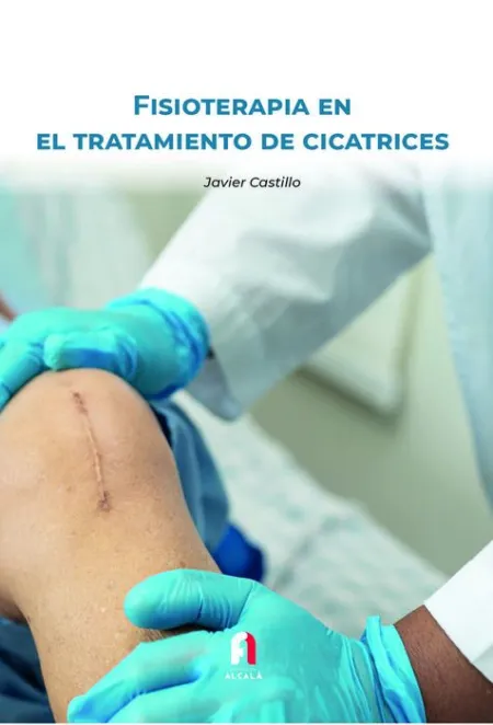 Fisioterapia en el Tratamiento de Cicatrices