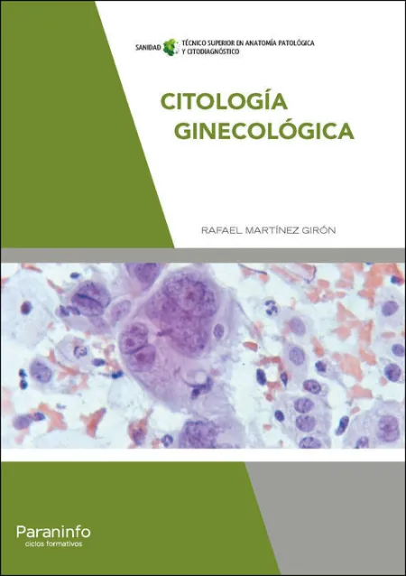 017 Cf/Gs Citología Ginecológica