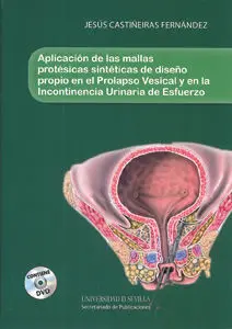 Aplicaciã?Â³N de las Mallas Protã?Â©Sicas Sintã?Â©Ticas de Diseã?Â±O Propio en el Prolapso Vesical y en la Incon