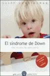 Sindrome de Down, el.