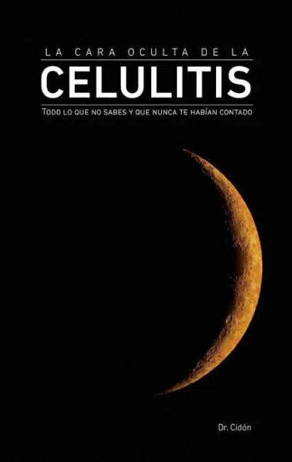 La Cara Oculta de la Celulitis. Todo lo que no Sabes y que Nunca te Habian Contado