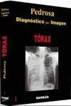 Torax. diagnostico por Imagen/1 -Cartone