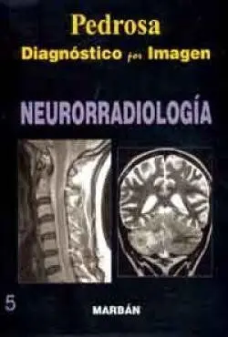Neurorradiologia