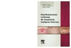 Manifestaciones Cutáneas de Neoplasias Malignas Internas