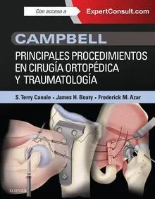 Campbell Principales Procedimientos en Cirugia Ortopedica y Traumatologia
