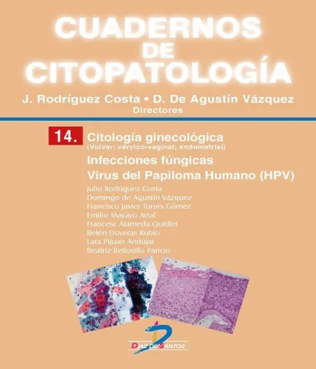 T14 Citología Ginecológica: Infecciones Fúngicas. virus del Papiloma Humano (Hpv)