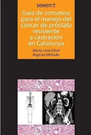 Guã?Â­as de Consenso para el Manejo del Cã?Â¡Ncer de Prã?Â³Stata Resistente a Castraciã?Â³N en Catalunya