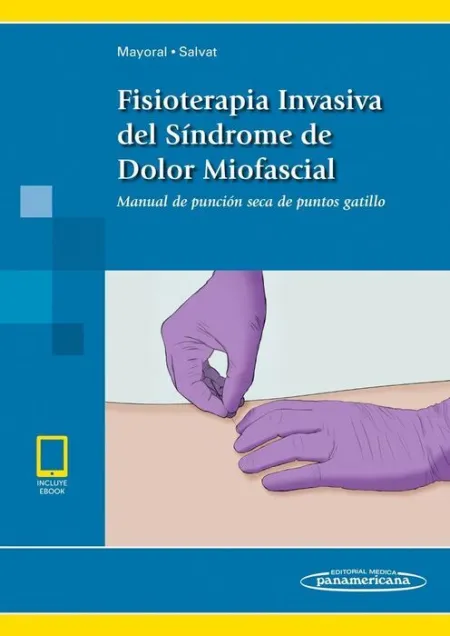 Fisioterapia Invasiva del Síndrome de Dolor Miofascial (Incluye Versión Digital)