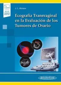 Ecografia Transvaginal en la Evaluación de los Tumores de Ovario
