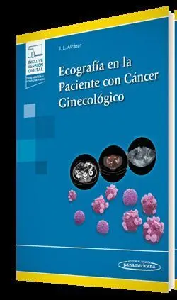 Ecografía en la Paciente con Cáncer Ginecológico