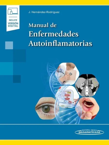 Manual de Enfermedades Autoinflamatorias ( E-Book)