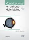 Complicaciones en la Cirugía del Cristalino + Acceso Web