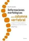 Deformaciones Morfológicas de la Columna Vertebral
