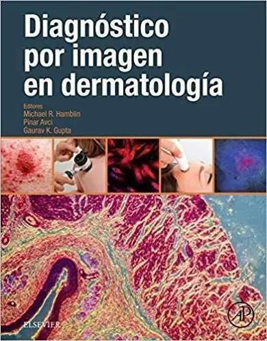 Diagnóstico por Imagen en Dermatología