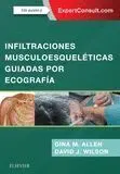 Infiltraciones Muscoesqueleticas Guiadas por Ecografía