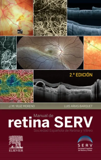 Manual de Retina Serv