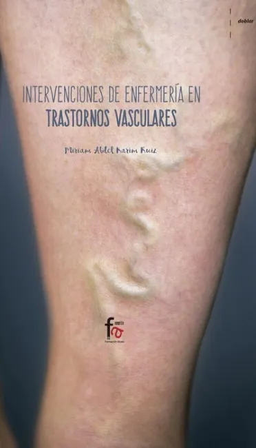 Intervencion de Enfermeria en Trastornos Vasculares