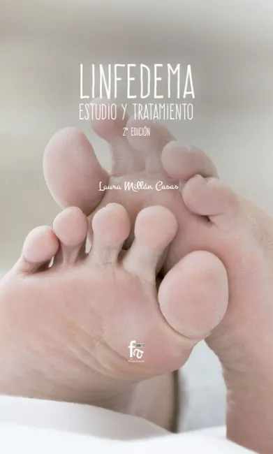 Linfedema. Estudio y Tratamiento
