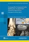 Tomografia Computarizada Multicorte en Patologia Musculoesqueletica