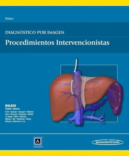 Diagnostico por Imagen:procedimientos Intervencionistas