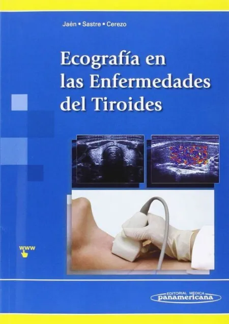 Ecografía en las Enfermedades del Tiroides