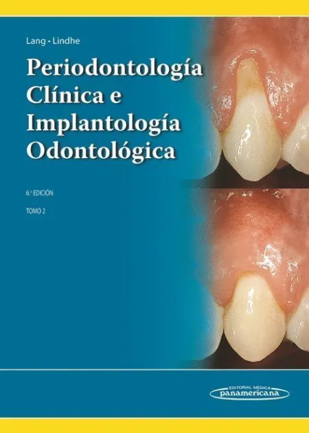 T2 Periodontología Clínica e Implantología Odontológica