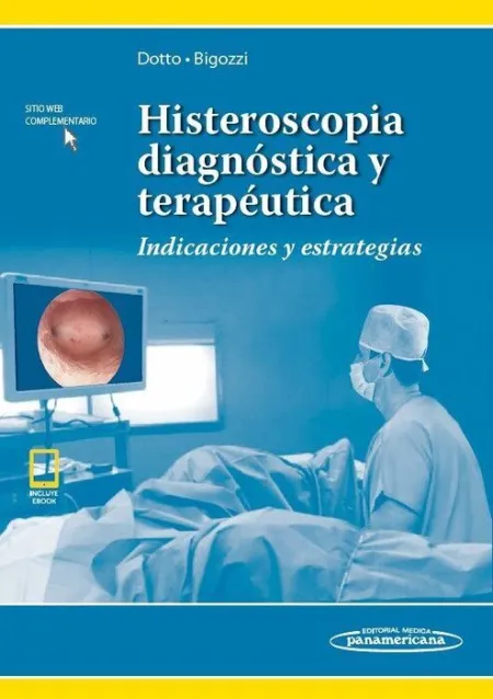 Histeroscopia Diagnostica y Terapeutica.