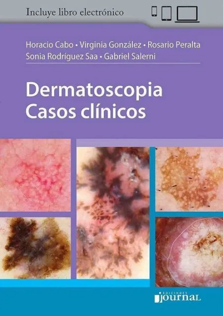 Dermatoscopia Casos Clinicos