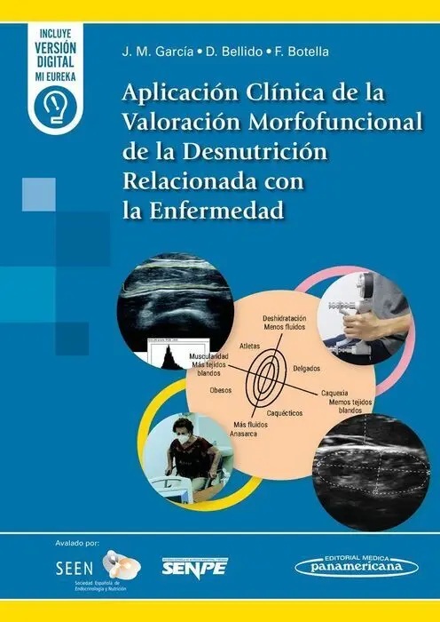 Aplicacion Clinica de Valoracion Morfofuncional de la Desnutricion Relacionada con la Enfermedad