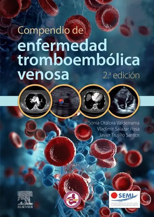 Compendio de Enfermedad Tromboembólica Venosa, 2. ª Edición
