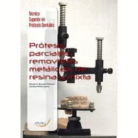 Protesis Parciales Removibles Metalicas de Resina Mixta