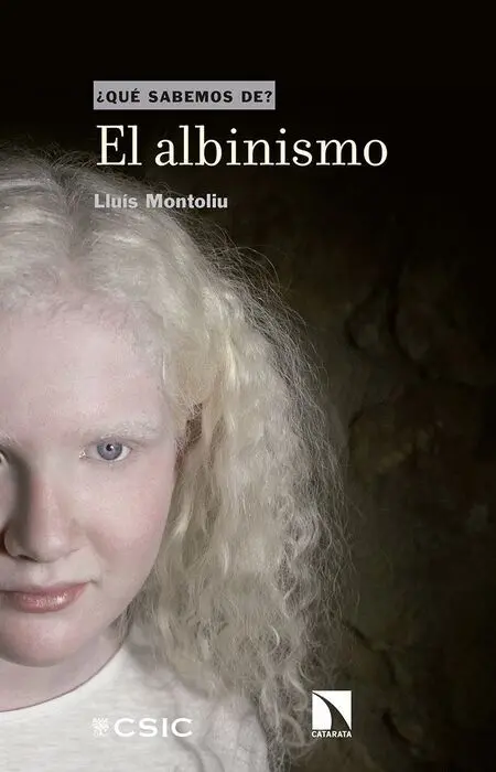 El Albinismo