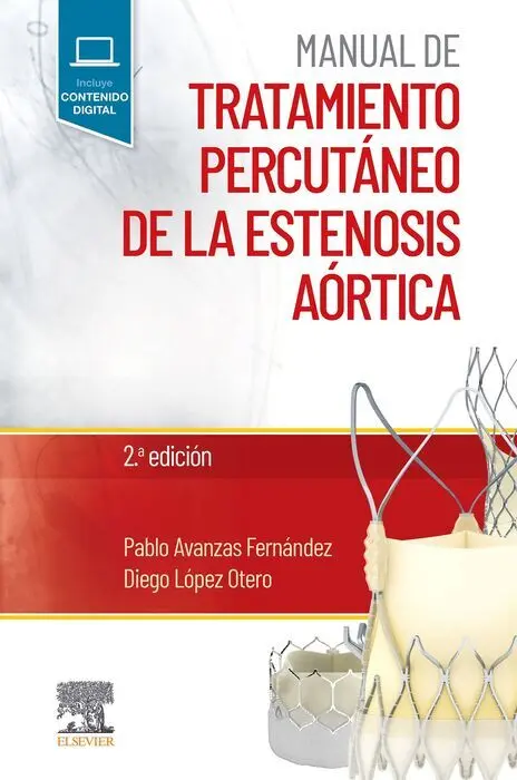 Manual de Tratamiento Percutáneo de la Estenosis Aórtica, 2. ª Edición